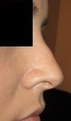 The left side bump is slightly visible.