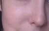 My skin (no makeup). You can see the freckling here.