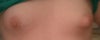 Front view of transition between swollen and unswollen