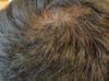 Back of head