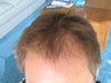 my  hairs