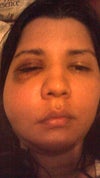 2 weeks after the accident