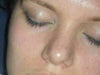Visible roundness, that doesn't seem to go away