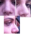 Around 1 month