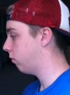 What my jaw looks like.