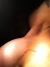 yellowish shadow around boob