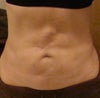 This was taken in Sept 2012, after the "Aqua Lipo" revision. As you can soo, NO IMPROVEMENT!