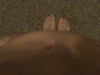 My view from the top down... honestly not the view I expected after a tummy tuck :(  I would have hoped to be able to at least have a flat enough tummy to be able to see my upper thighs!