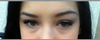My under eye bags