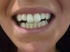 Front view of teeth