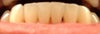 Black triangle lower front