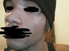 This is the left side you can see the right nostrol is bulging out more.