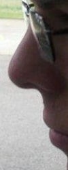 My nose 2 years ago, no breathing/congestion problems.