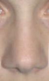 morphed