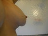 left breast arm raised