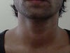 I realize its a bit hard to see via my webcam. However in person its much more noticeable. Look closely and you can see its kind of just a light colored crease compared to the rest of my skin tone.