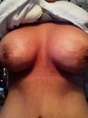 week 4 right breast is fine no pain the left has gone down over the this week but it feels as if there is a pocket on the uper pole. dihdrocdine for pain not really working.
