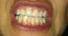The asymmetry on the two center front duplicates my natural asymmetry...I'm okay with that!  But not pain.