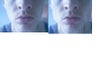 crude photoshop of how jaw implants *might* look??