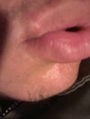 Lip