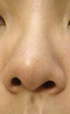 Front View (Camera at my nose' level)