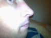 new nose