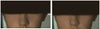 the before and after