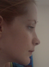 New lumpy lateral crura and exaggerated tip break
