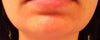 Frontal view.