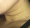 It goes all the way underneath the collarbone