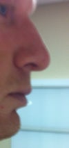 lateral..head tilted slightly down