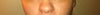 Uneven nostrils