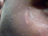 right eye