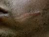 Left cheek