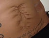 Mine looks a lot different from others I have seen. Can an extensive scar like this be removed?