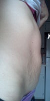 Side view. Can see stretch marks