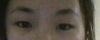 Asian eyes enlargement