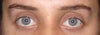 prominent eyes