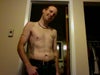 tummy tuck on a man?