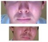 26 year old thin/skinny male with prominent cheeks