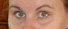 restylane qualifications and training to inject
