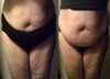 belly after twins