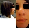 middle eastern female nose