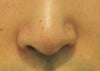 Asymmetrical Nostrils