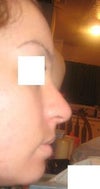 curved nose profile