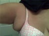 breast lumpectomy axillary tail removal