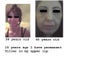 non surgical rejuvenation for 44 year old woman