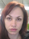 Do I need a Facelift at 31?