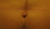 Umbilicoplasty for a Male