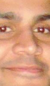 He feels there are 3 problems  with the appearance of his nose:

1)      The base of the nose is  wide.

2)      The tip of the nose to be lifted a bit

3)      The sides of the  bridge of nose is wide.